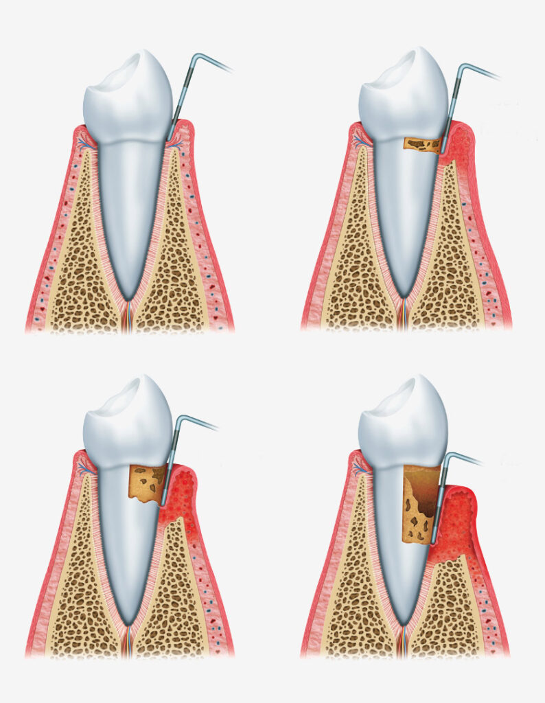 parodontologia